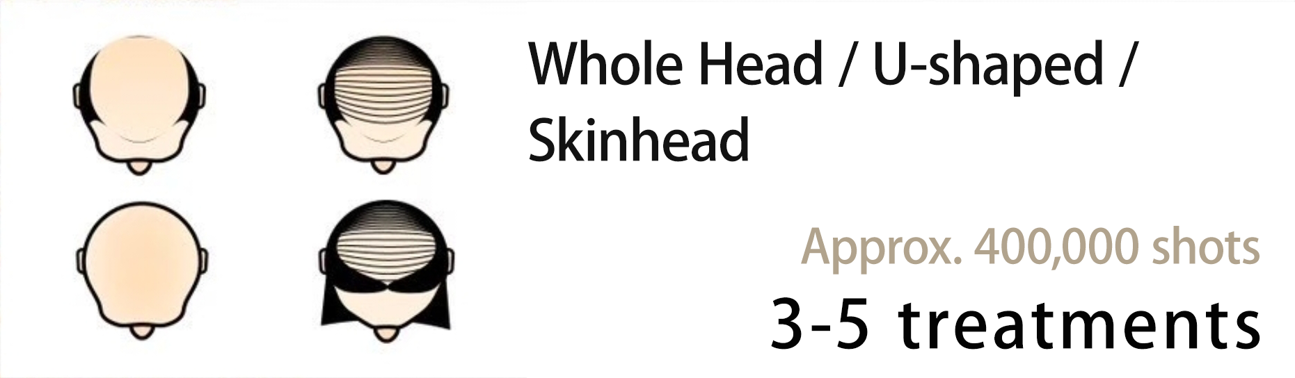 Whole Head / U-shaped / SkinheadApprox. 400,000 shots3-5 treatments回