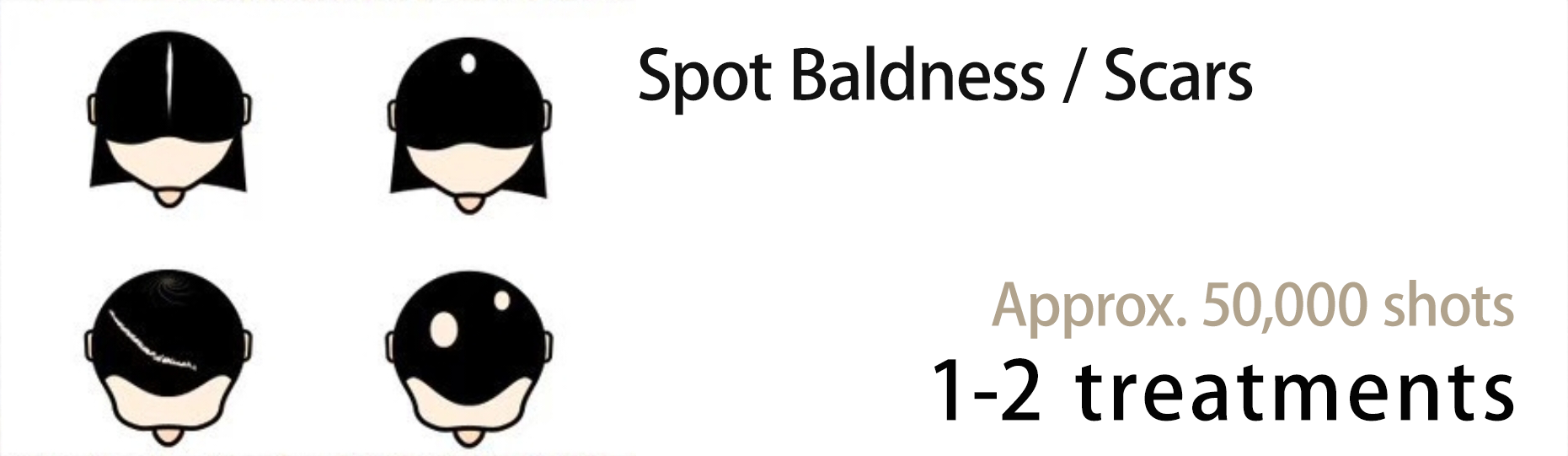 Spot Baldness / Scars Approx. 50,000 shots1-2 treatments