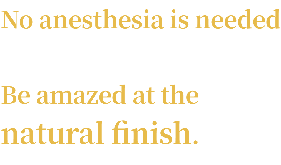 No anesthesia is needed as the pain is minimal.
Be amazed at the natural finish.