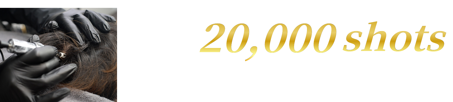 Try 20,000 shots for free Limited to people who can permit photoshoots